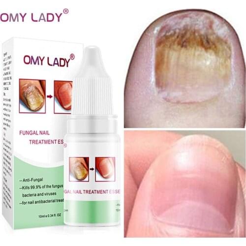 LAIKOU Cuticle Oils