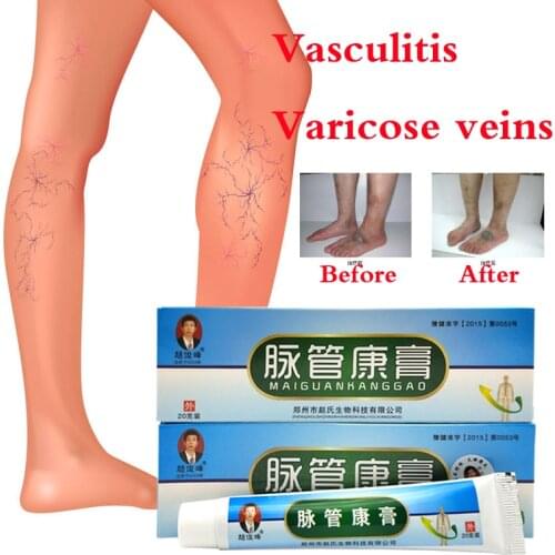 2boxes Chinese natural herbal medicine for treating varicose vascular inflammation massage cream cure varicose vein ointment
