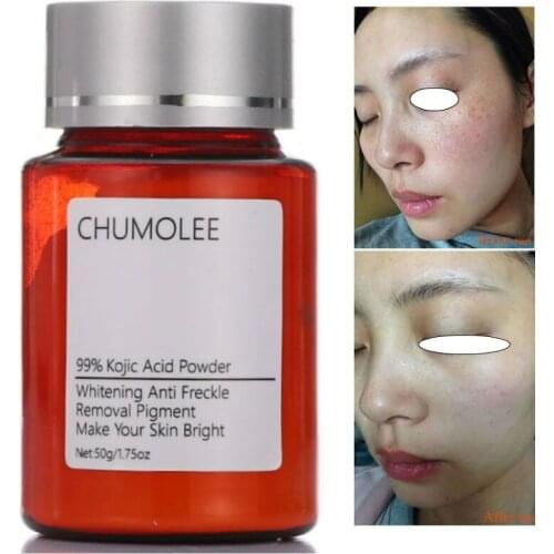 Chumolee Pure 99% Kojic Acid Powder Whitening Face Cream Remove Freckle Melasma Acne Scars Pigment Melanin Dark Sopts Face Care