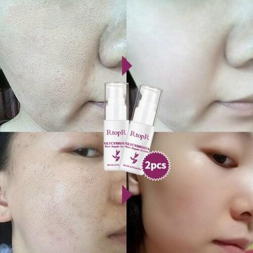 Glycyrrhiza Repair Serum Shrink Face Pore Oil Control Anti Wrinkle Whitening Cream Effectively eliminate acne marks