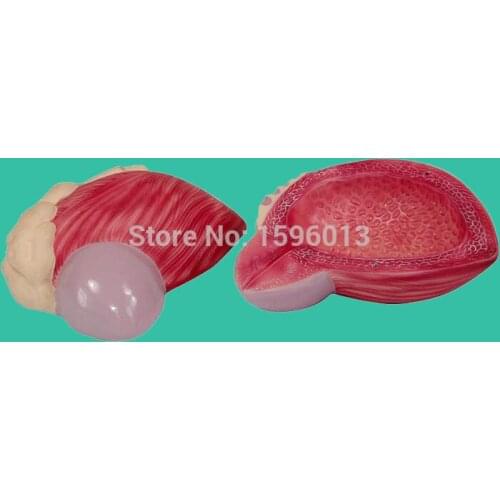 Expansion Urinary Bladder Model, Expansion Model of Urinary Bladder