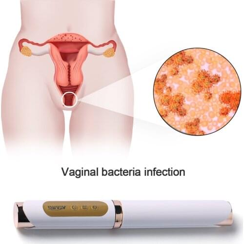 Vaginal Tightening gynecology vaginitis cervical erosion birth canal rehabilitation Dry and relaxation vaginal Postpone menopaus