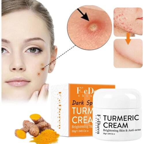 30ml Herb Turmeric Face Cream Removal Blackhead Moisturizer Whitening Repair Acnes Scar Dark Spot Brightening Facial Skin Care