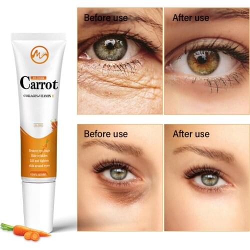 Minch Carrot Eye Cream Remove Eye Bags Blemish Anti Puffiness Dark Circles Delays Anti-wrinkles Firming Brighten Skin Unisex