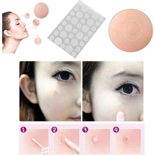 Acne Pimple Patch Stickers Acne Pimple Remover Tool Absorb Pus And Oil Acne Patch Skin Care As Protective Cover 36 Patches/set