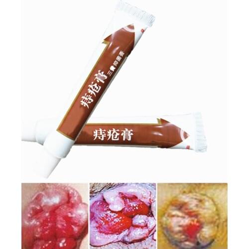 Hemorrhoids Ointment Chinese Medicine Cream Painkiller Pain Relief External Anal Fissure Plaster Plant Herbal Medical Materials