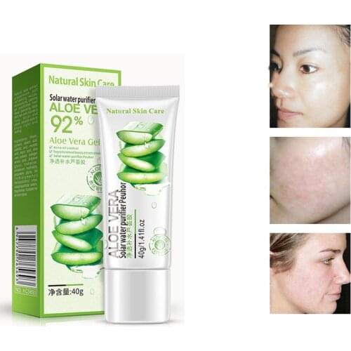 40g ROREC Natural Aloe Vera Smooth Gel Acne Whitening Treatment Face Cream for Hydrating Moist Repair After Sun Sleeping Mask