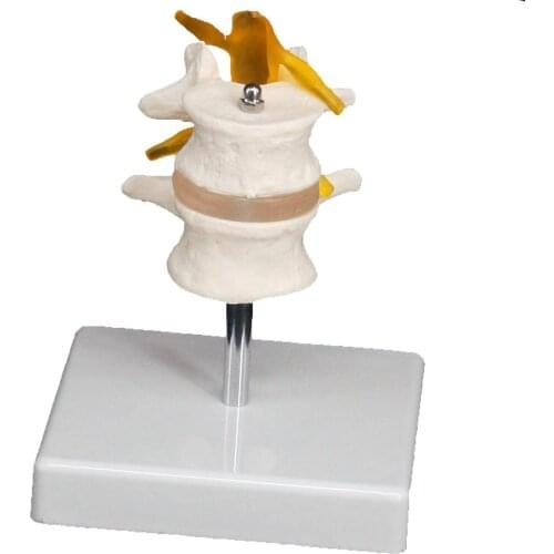 Life Size Two Section Lumbar Spine Skeleton Model with Stand Medical Teaching Trainin Aid