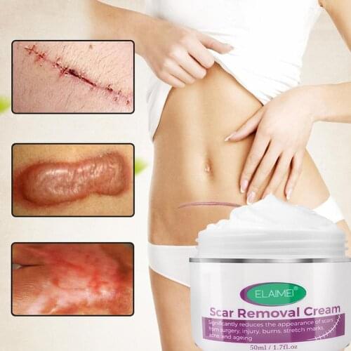 Acne Scar Removal Cream Repair Acne Spots Acne Treatment Blackhead Whitening Shrink Pores Stretch Marks Skin Care