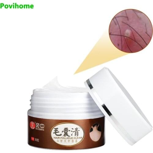 30G Anti-itch Ointment for Hair Skin Folliculitis Treatment Eczema Psoriasis Cream Antibacterial Anti Infection Plaster P0152