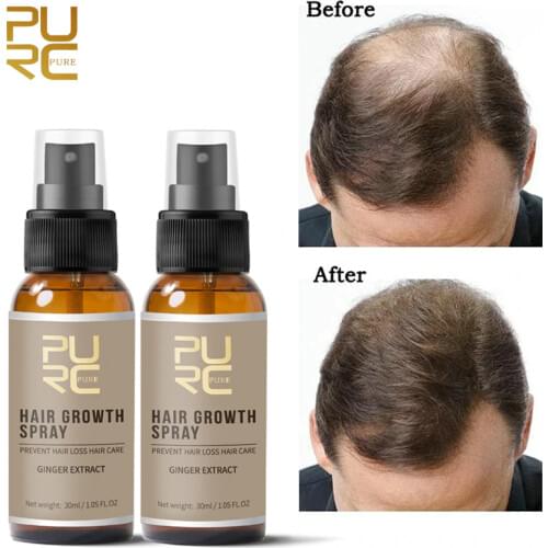2PCS 30ml Original Anti Hair Loss Spray Enhance Hair Root Strengthen Fast Hair Growth Serum Thick & Dense Hair Care