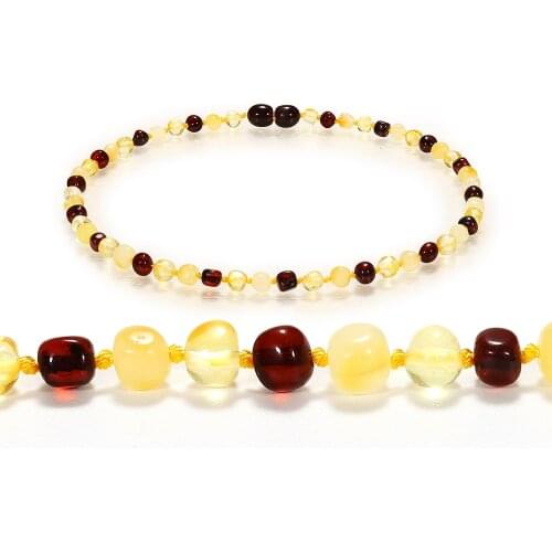 DOREMI 1Cherry1Gold1Honey Baby Teething Amber Bracelet Necklace for Boys Girl Amber Beads Natural Baltic Amber Neckace Jewelry