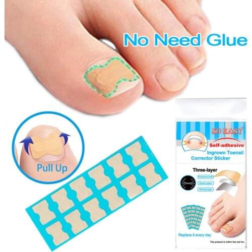 36Pcs/48Pcs/60Pcs/72Pcs/120Pcs Toenail Patches Self-Adhesive Three-Layer Fabric New Ingrown Toenail Corrector Sticker for Unisex