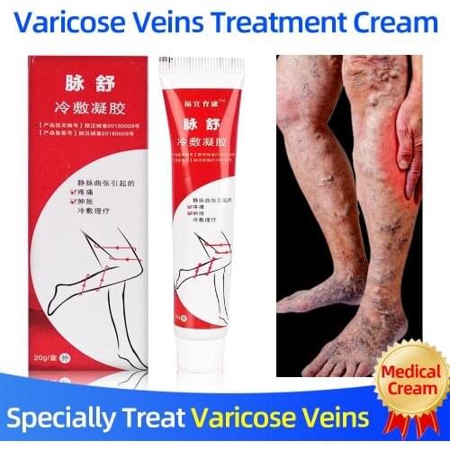 Varicose Vein Cold Compress Gel Phlebitis/Vasculitis Treatment Ointment Varicosity Angiitis Pain/Swelling Relief Body Care Cream