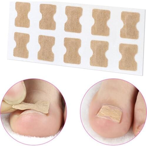 Ingrown Toenail Corrector Sticker Paronychia Treatment Fixer Recover Corrector Pedicure Foot Toe Nail Care Tool Glue Free 50pcs