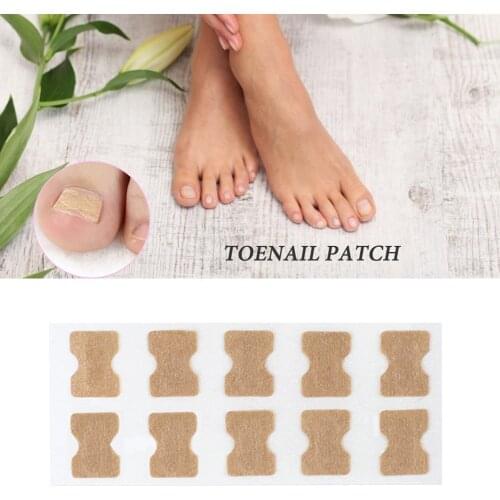 Pedicure Foot Toe Nail Care Glue Ingrown Toenail Corrector Paronychia Treatment Recover Foot Toe Nail Care Tool