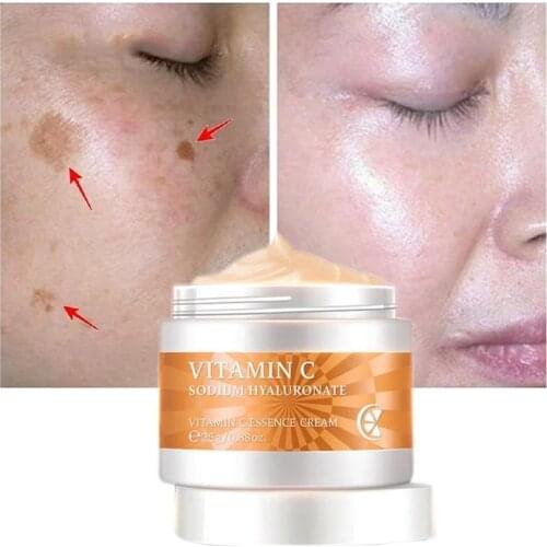 Vitamin C Whitening Face Cream Remove Dark Spots Melanin Repair Fade Freckles Facial Cream Anti Aging Brighten Tone Skin Care