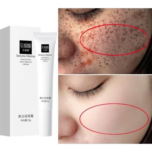 Import Nicotinamide Freckles Whitening Face Cream hyaluronic acid Anti-Wrinkle Cream Remove Spots Firming Dark Circles Skin Care