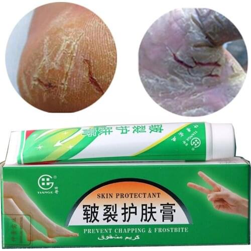 Plantar Crack Care Cream 100% Herbal Hand Foot Skin Splitting Cure Hydrating Ointment Chinese Medicine Cleft Treatment Plaster