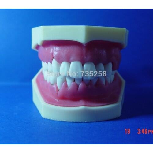 Advanced Periodontal Disease Model,Oral And Periodontal Disease Teaching Model