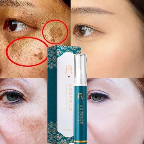 Effective Whitening Freckle Cream Remove Melasma Acne Spot Pigment Melanin Dark Spots Pigmentation Moisturizing Gel Skin Care