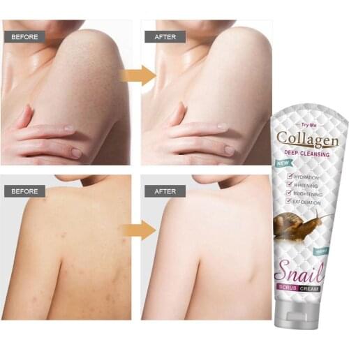 LAIKOU Collagen Scrub Body Scrub Face Snail For Exfoliating Whitening Moisturizing Treatment Acne Exfoliating Brightening Scrub