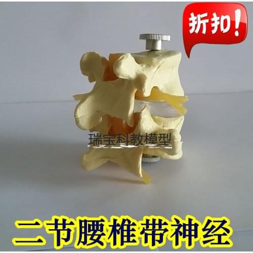 Human model spinal cord nerve model lumbar intervertebral disc has nerve vertebra with holder free shipping