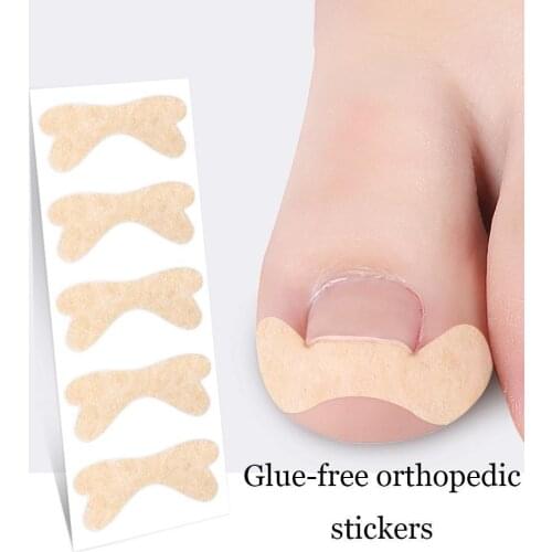 Nail Tape Stickers Anti-roll Nails Glue-free Toe Inlay Nails Corrector Nail Patch Pull Manicure Dedicated Sticker