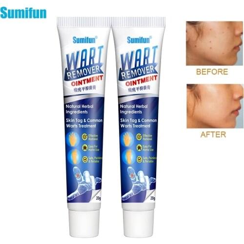 Sumifun 2pcs Warts Remover Cream Antibacterial Ointment Foot Corn Plaster Skin Tag Remover Thorn Pain Relief Foot Care Cream