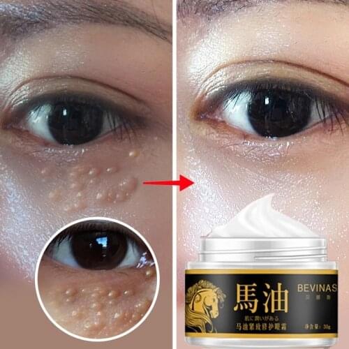 Effective Anti-Wrinkle Whitening Skin Care Horse Oil Cream Anti-aging Face Cream Eye Serum Remove Fat Granule Dark Circles 40g