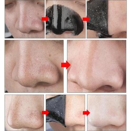 5pcs Mineral Mud Mask Face Care Black Mask Nose Blackhead Remover Treatment Black Pore Mask Head Acne Mask Cleanser Peel Po V0S5