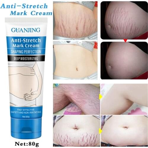 Hot sale Remove Pregnancy Scars Acne Cream Stretch Marks Treatment Maternity Repair Anti-Aging Anti-Winkles Firming Body Creams