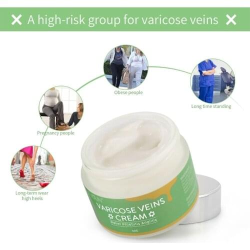 Varicose Veins Cream for Legs Relieves Varicose Vein Discomfort Pain Strain 50JF