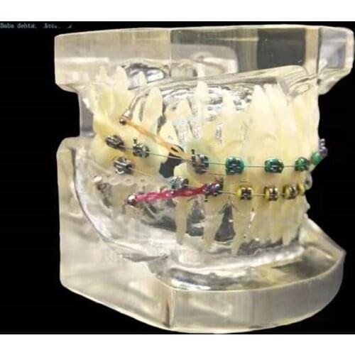 Wrong Jaw correction Teaching Tooth Model M3005/Transparent Orthodontic teeth model/Fault Correction Tooth model With ligature