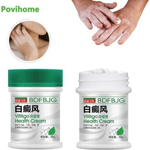 White Spot Disease Treatment Ointment Leukoplakia Disease Repair Cream Vitiligo Chinese Medical Pigment Melanin Skin Care Balm