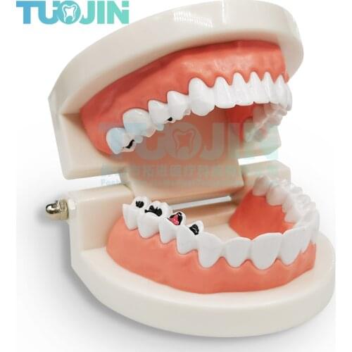 Teeth Model Dental Standard Oral Model Tooth Decay Pathology Model Teaching Kindergarten Demonstration Brushing Teeth Tools Kit