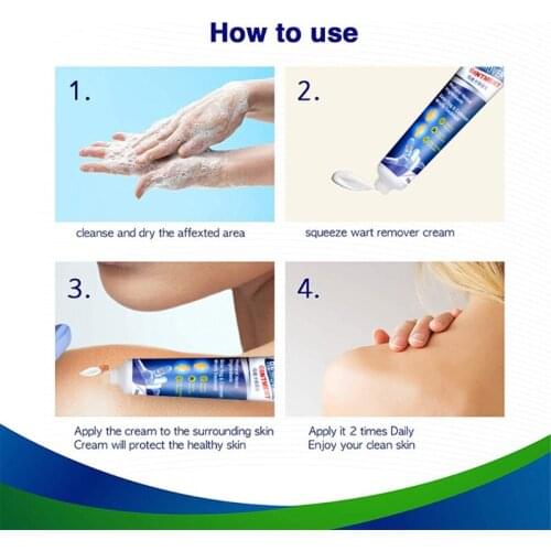 Wart Removal Body Warts Treatment Cream Foot Care Cream Skin Tag Remover