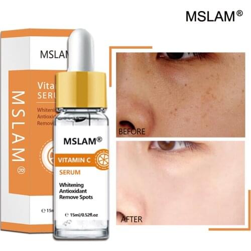 MSLAM Natural 15ml Skin Care Facial Care Freckle Whitening Pore Contraction Vitamin C Essence Nutrient Solution Serum