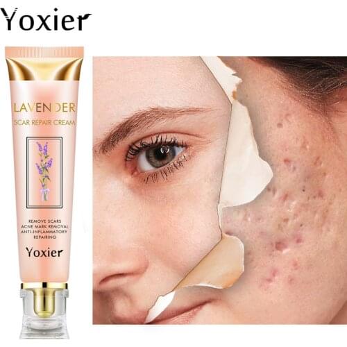 Yoxier Lavender Scar Repair Cream Acne Scar Stretch Marks Pigmentation Corrector Anti-allergic Calm Whitening Skin Care 20g