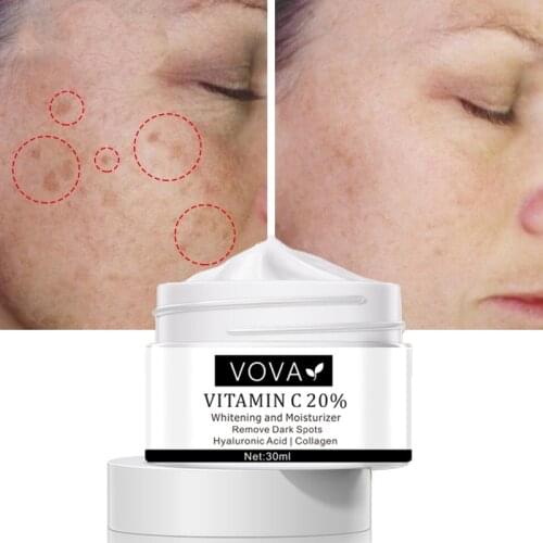 20% Vitamin C Face Whitening Cream Remove Dark Spots Anti-Aging Fade Freckls Speckle Melanin Remover Brightening Skin Care 30ml