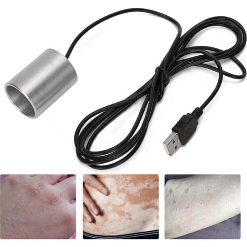 UVB Waveform Vitiligo Physiotherapy Light Treatment Instrument White Spot Body Pityriasis Rosea Vitiligo Therapy Lamp Device