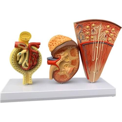 Human kidney anatomical model visceral glomerulus section renal corpuscles hospital school teaching aids