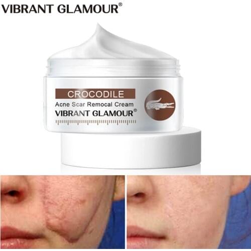 VIBRANT GLAMOUR Crocodile Repair Scar Anti -Wrinkle Aging Face Cream Moisturizing Whitening Oil-Control Shrink Pores Skin Care
