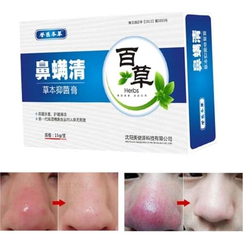 Herbal Anti Nose Mites Remove Acne Rosacea Cream Red Shrink Treatment Ointment Face Bleaching Pores Remover Nose Acne Black E1S4