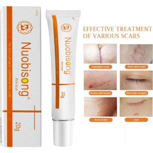Gel Cream Desalination Repair Scar Cream Remove Acne Scars Stretch Marks Creamsurgical Scar Burn For Body