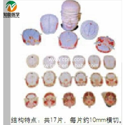 Human Head Neck Anatomical Transection Model BIX-A1072 WBW368