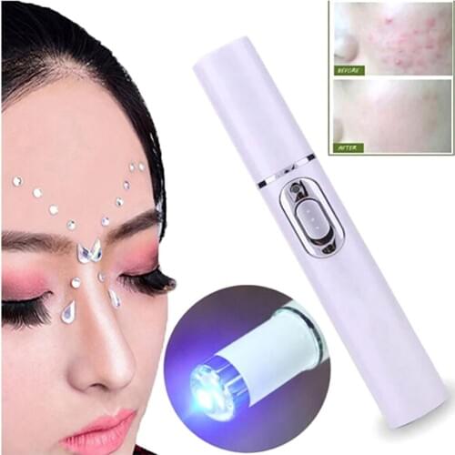 Portable Acne Laser Pen Wrinkle Removal Machine Durable Soft Scar Remover Blue Therapy Light Pen Massage Spider Vein Eraser