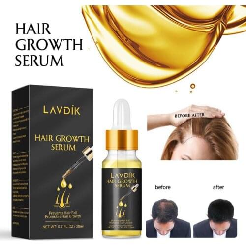 20ml Hair Growth Liquid Ginger Fast Hair Growth Serum Oil Anti Preventing Loss Deep Nourishes Repair Hair Growth Fluid TSLM1