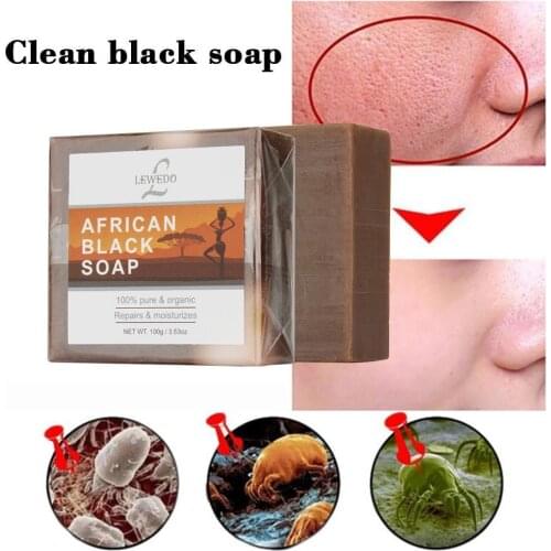 100g Cleansing African Black Soap Black Soap Body Moisturizing Skin Mites Removal Soa Care Cleansing Skin Black H5Y7