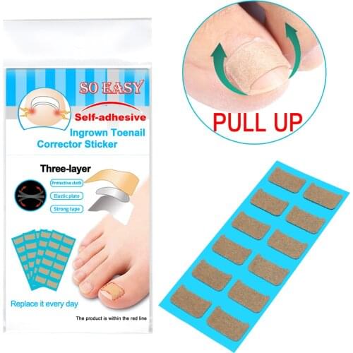 60Pcs Ingrown Toenail Correction Stickers Nail Corrector Patches Paronychia Treatment Recover Sticker Pedicure Foot Care Tools